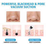 Vanity Deep Pore Blackhead Remover